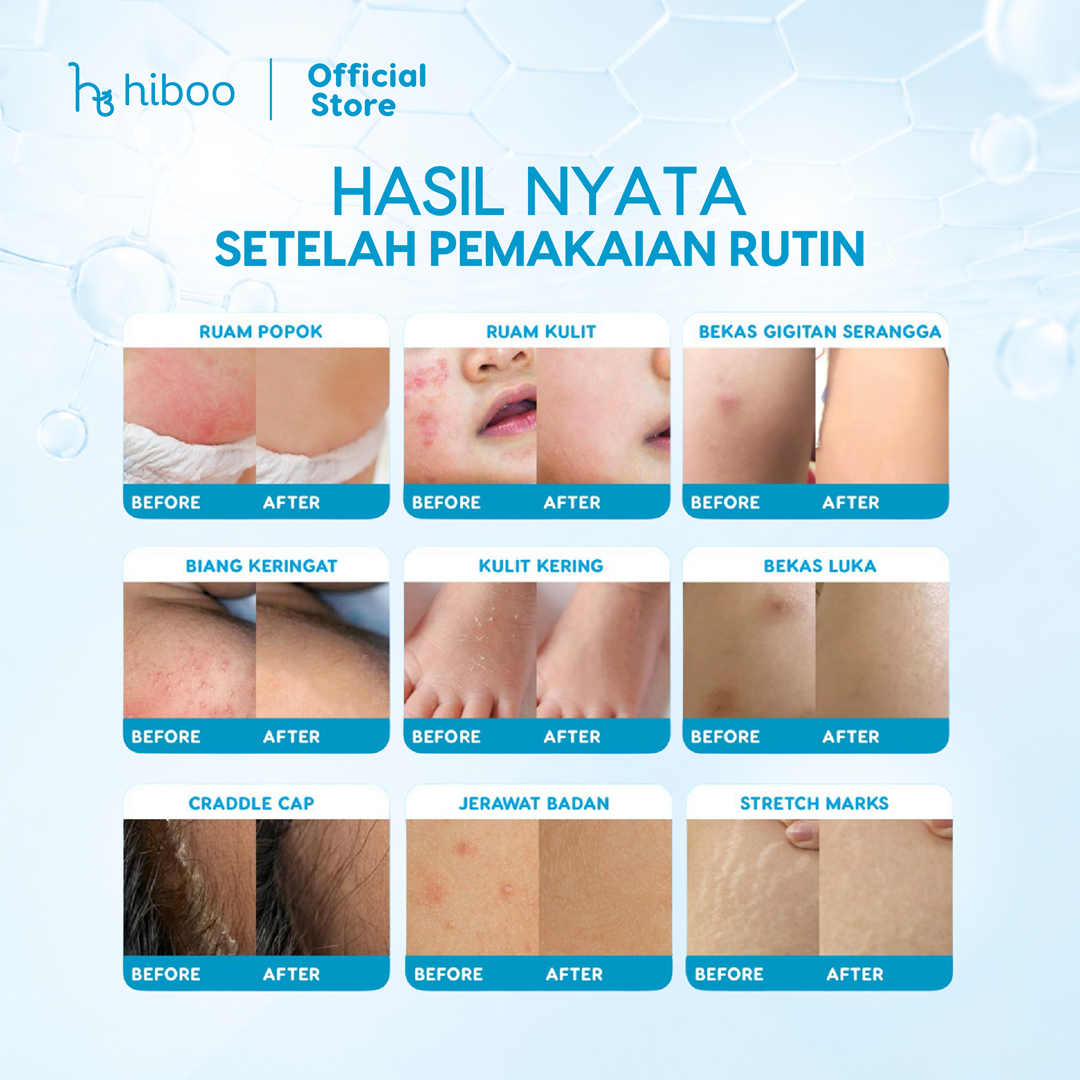 Bye Ruam Combo - 15 gram